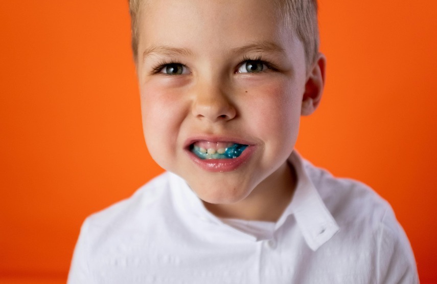 Tratamiento de fluorización dental en niños