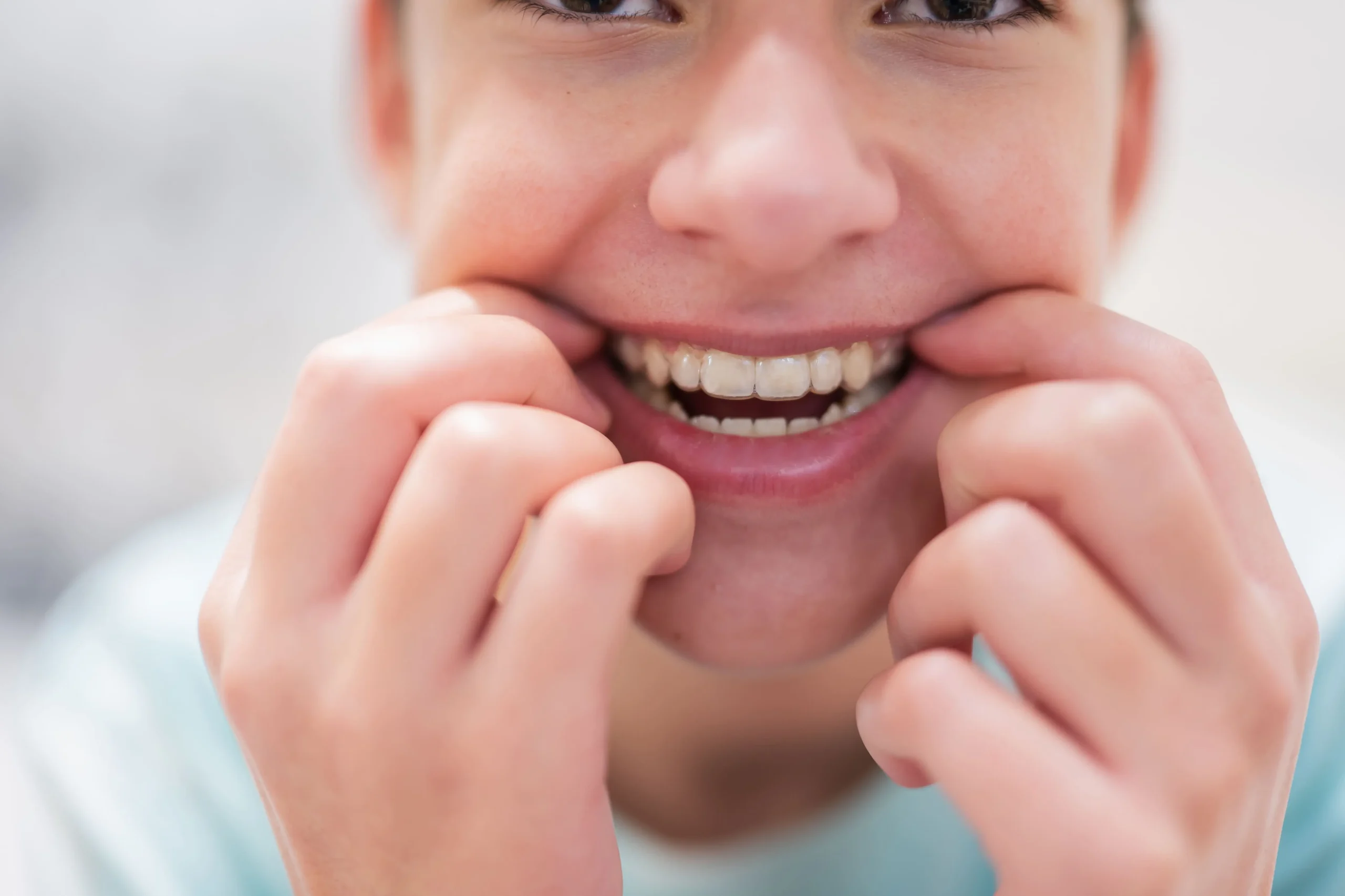 ventajas ortodoncia invisible adolescentes